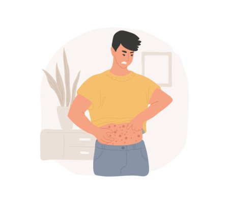 Recrudescence des cas de gale en Occitanie